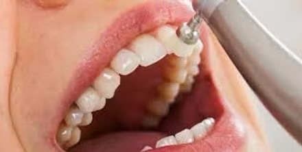 Professional teeth whitening service at our dental clinic
